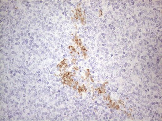 APOBR Antibody in Immunohistochemistry (Paraffin) (IHC (P))