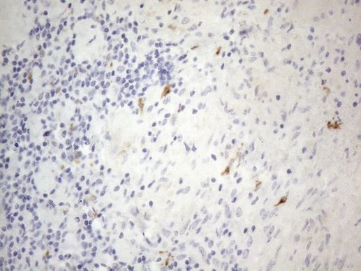 APOBR Antibody in Immunohistochemistry (Paraffin) (IHC (P))