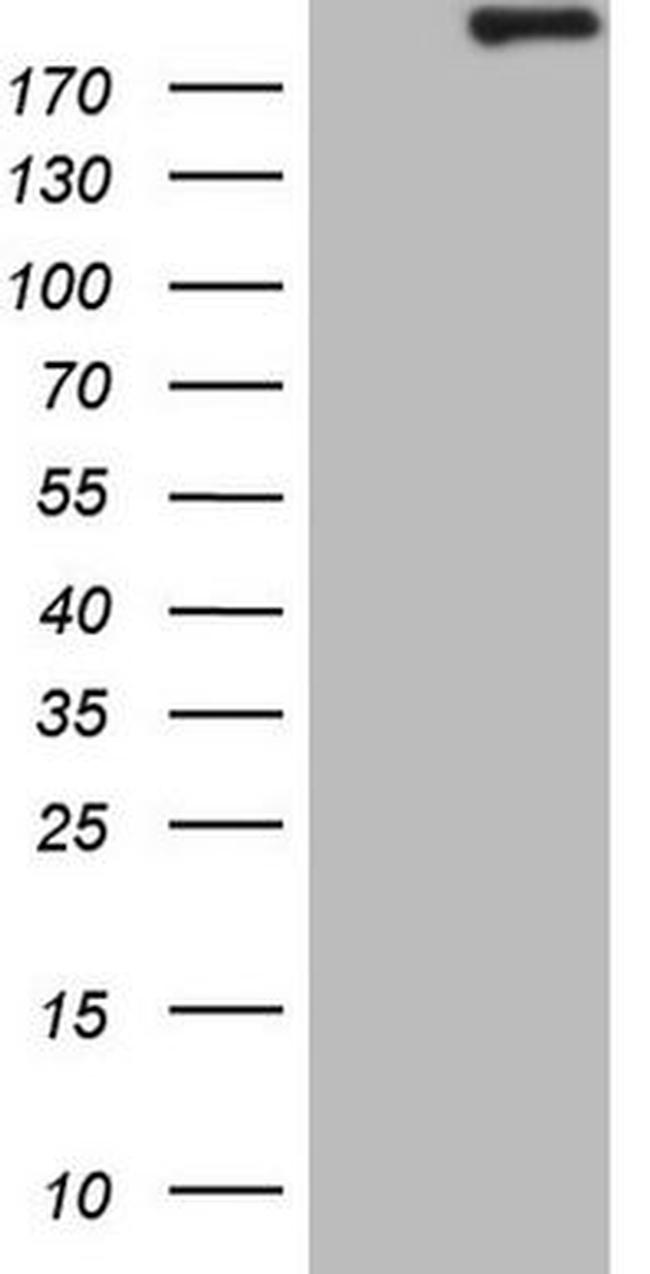 APOBR Antibody in Western Blot (WB)