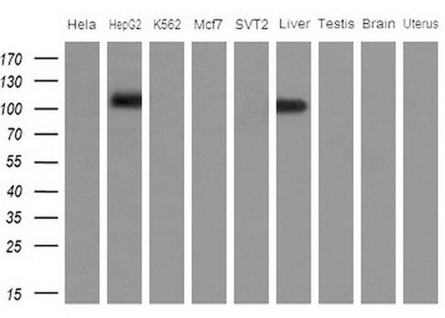 APOBR Antibody in Western Blot (WB)