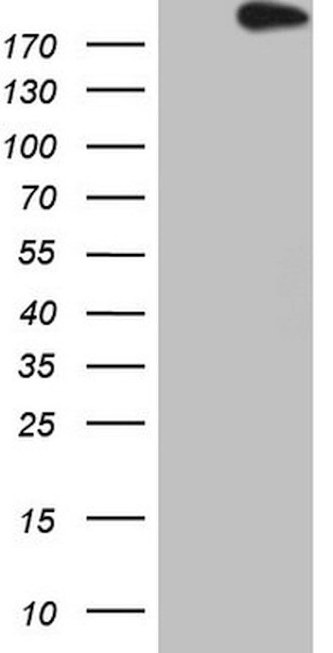 APOBR Antibody in Western Blot (WB)