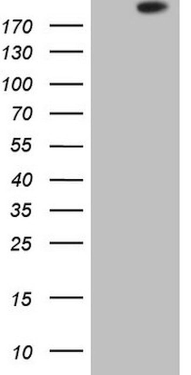 APOBR Antibody in Western Blot (WB)