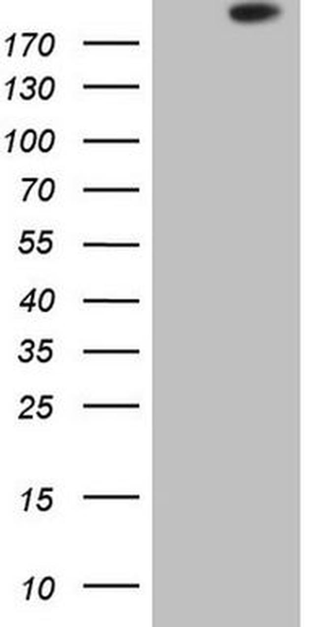 APOBR Antibody in Western Blot (WB)