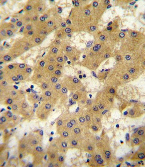 Apolipoprotein F Antibody in Immunohistochemistry (IHC)