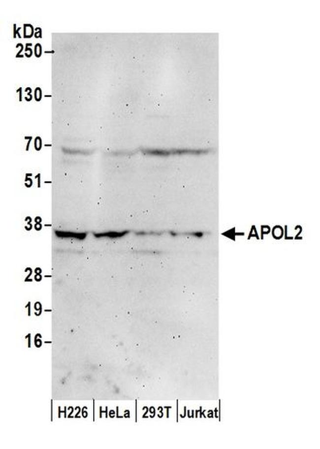 APOL2 Antibody in Western Blot (WB)
