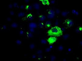 APP Antibody in Immunocytochemistry (ICC/IF)