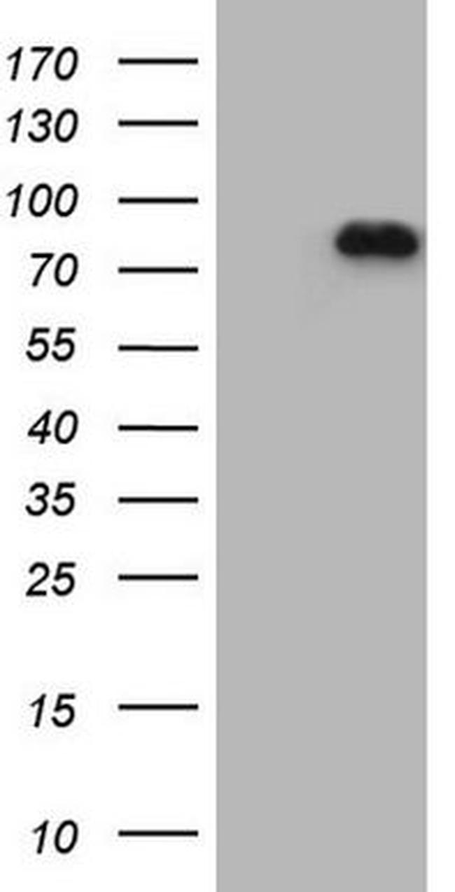 APPL1 Antibody in Western Blot (WB)