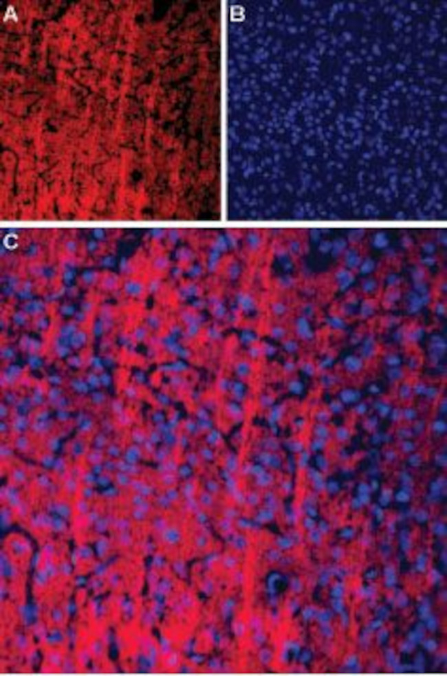 P2X2 Receptor Antibody in Immunohistochemistry (IHC)