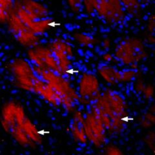 P2Y12 Receptor Antibody in Immunohistochemistry (IHC)