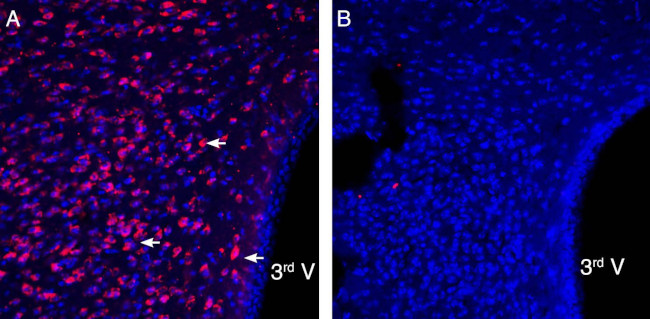 P2X3 Antibody in Immunohistochemistry (Frozen) (IHC (F))