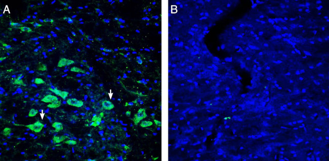Platelet-activating factor receptor (extracellular) Antibody in Immunohistochemistry (Frozen) (IHC (F))