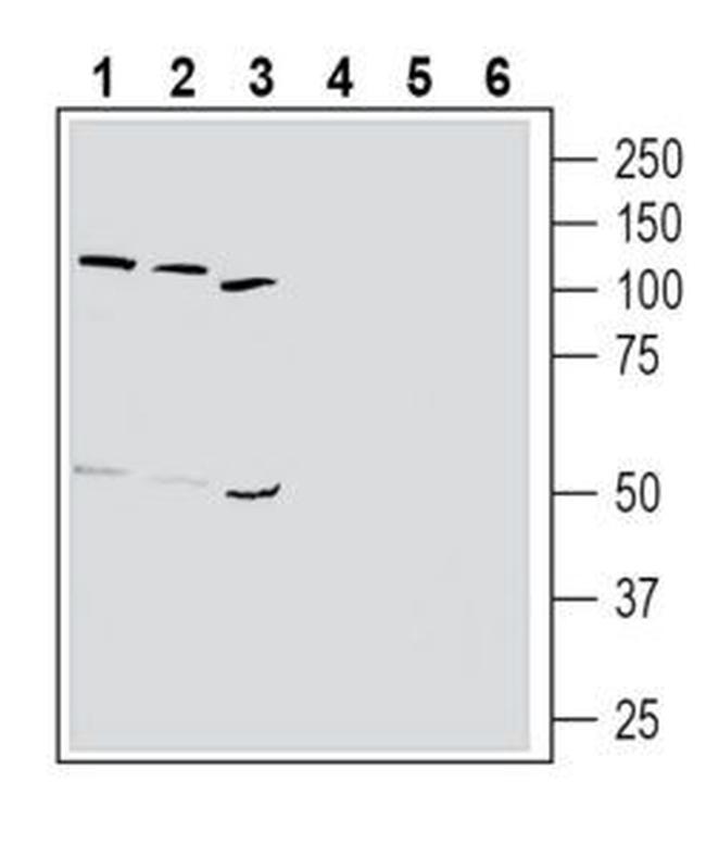Thromboxane A2 Receptor (extracellular) Antibody in Western Blot (WB)