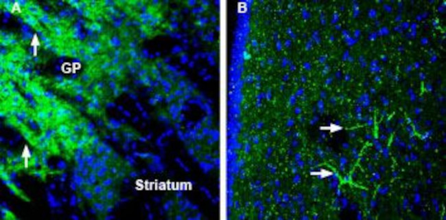 SynGAP Antibody in Immunohistochemistry (Frozen) (IHC (F))