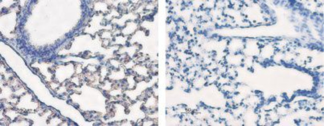 Aquaporin 5 Antibody in Immunohistochemistry (IHC)