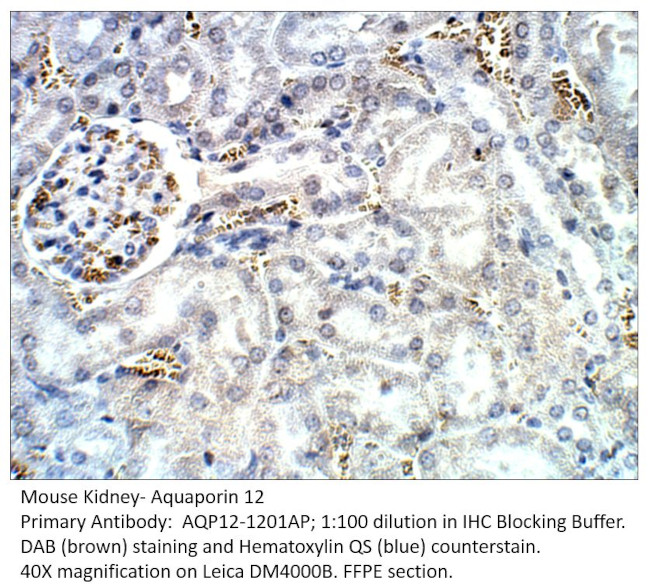 Aquaporin 12 Antibody in Immunohistochemistry (IHC)