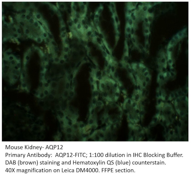 Aquaporin 12 Antibody in Immunohistochemistry (IHC)