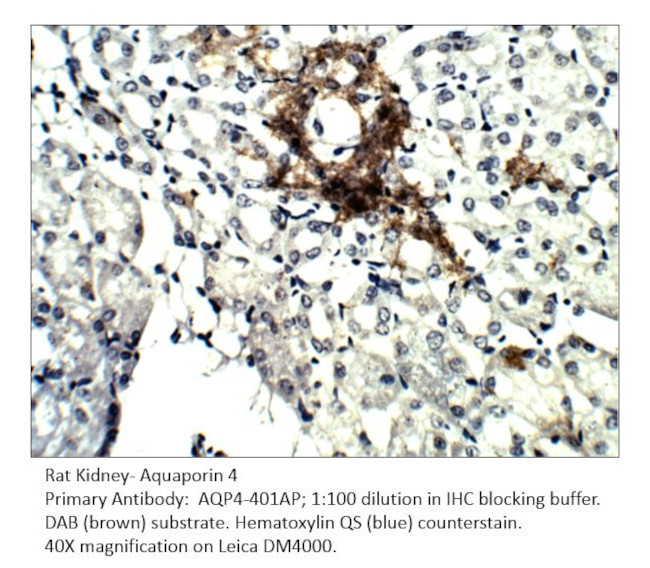 Aquaporin 4 Antibody in Immunohistochemistry (IHC)