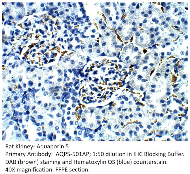 Aquaporin 5 Antibody in Immunohistochemistry (IHC)