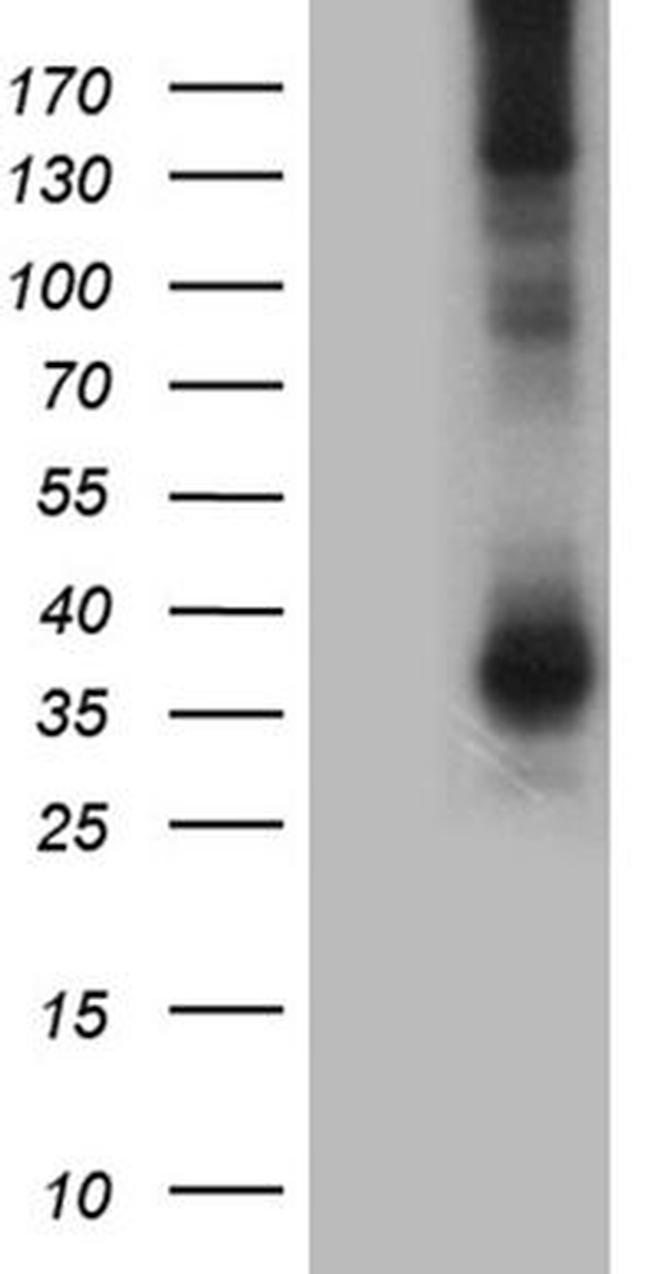 AQP8 Antibody in Western Blot (WB)