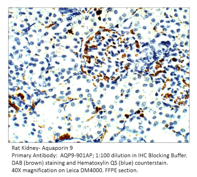 Aquaporin 9 Antibody in Immunohistochemistry (IHC)