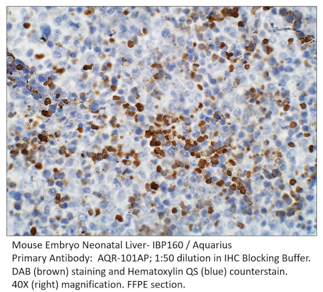 IBP160 Antibody in Immunohistochemistry (IHC)