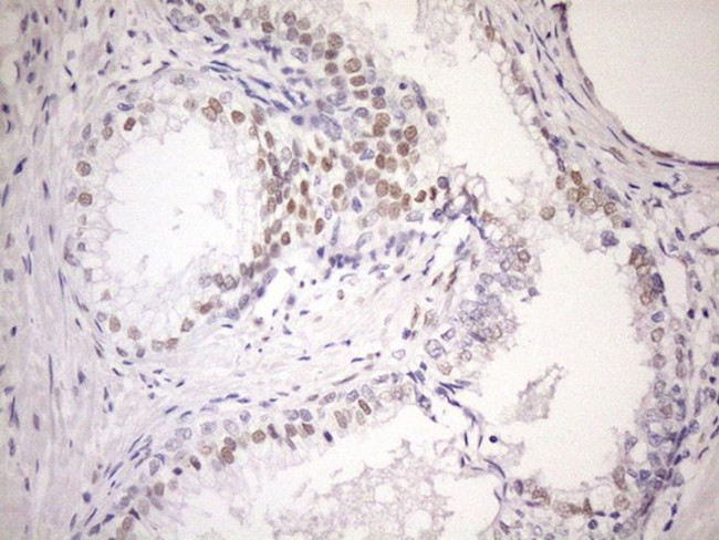 AR Antibody in Immunohistochemistry (Paraffin) (IHC (P))