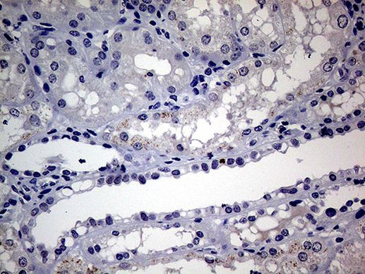 AR Antibody in Immunohistochemistry (Paraffin) (IHC (P))