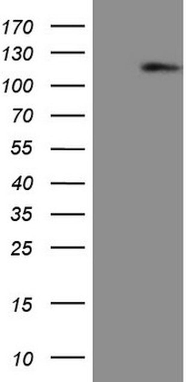 AR Antibody in Western Blot (WB)