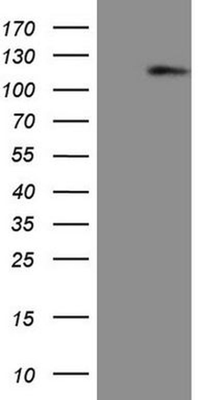 AR Antibody in Western Blot (WB)