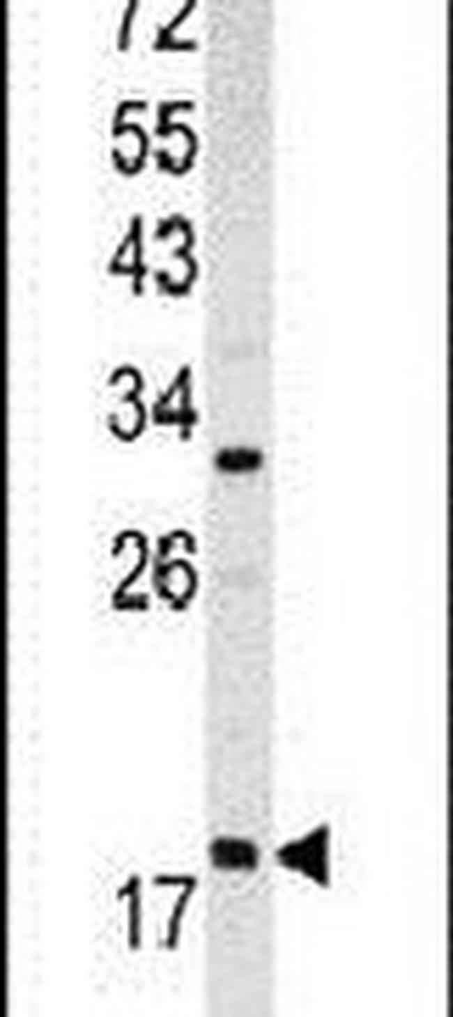 ARF3 Antibody in Western Blot (WB)