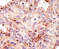 ARFGAP1 Antibody in Immunohistochemistry (IHC)
