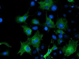 ARFGAP1 Antibody in Immunocytochemistry (ICC/IF)