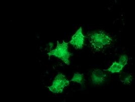 ARFGAP1 Antibody in Immunocytochemistry (ICC/IF)
