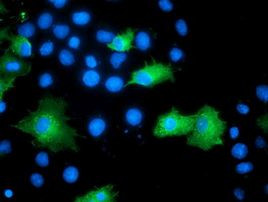 ARFGAP1 Antibody in Immunocytochemistry (ICC/IF)