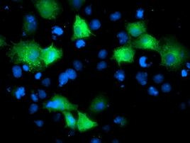 ARFGAP1 Antibody in Immunocytochemistry (ICC/IF)