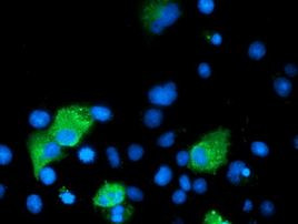 ARFGAP1 Antibody in Immunocytochemistry (ICC/IF)