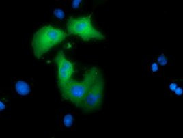 ARHGAP25 Antibody in Immunocytochemistry (ICC/IF)