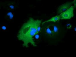 ARHGAP25 Antibody in Immunocytochemistry (ICC/IF)