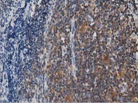 ARHGAP25 Antibody in Immunohistochemistry (Paraffin) (IHC (P))