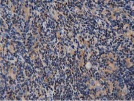 ARHGAP25 Antibody in Immunohistochemistry (Paraffin) (IHC (P))