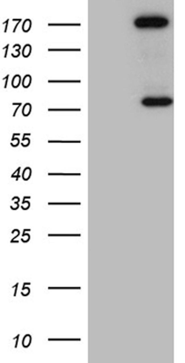 ARHGAP5 Antibody in Western Blot (WB)