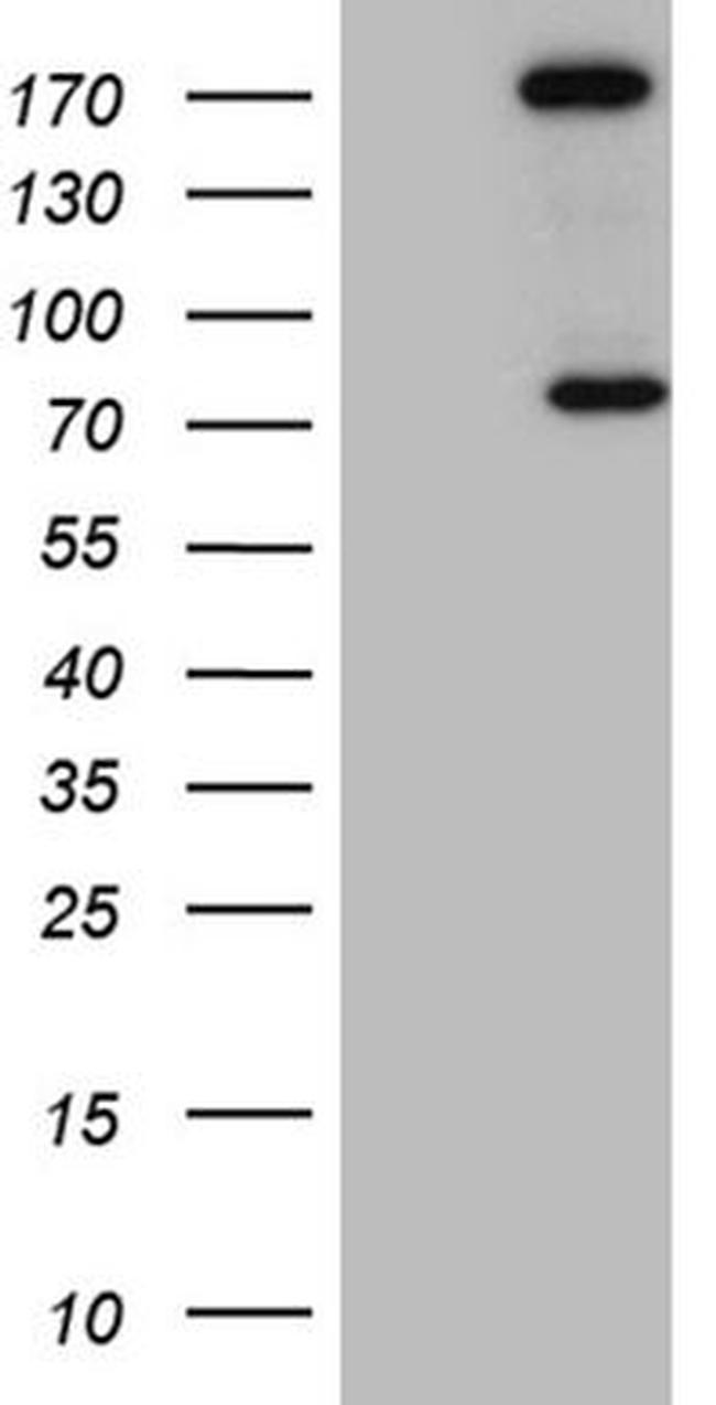 ARHGAP5 Antibody in Western Blot (WB)