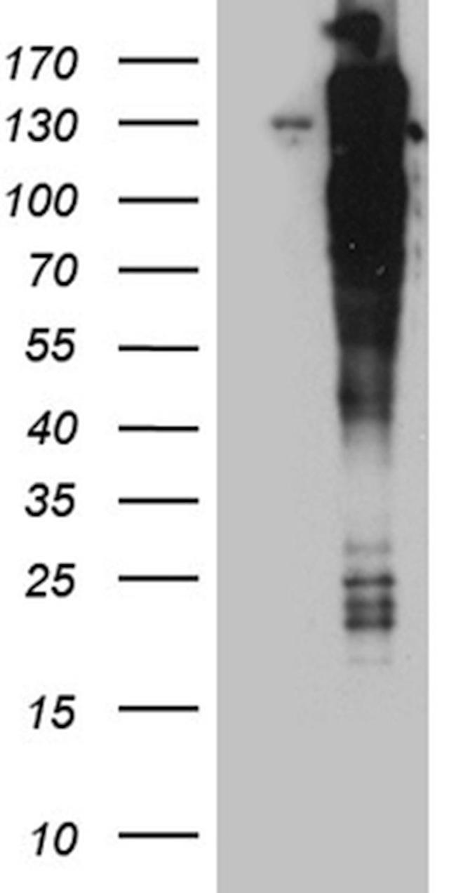ARHGEF18 Antibody in Western Blot (WB)