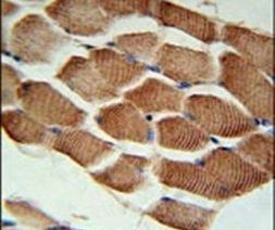 ARHGEF3 Antibody in Immunohistochemistry (IHC)