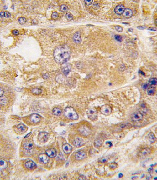 LDLRAP1 Antibody in Immunohistochemistry (IHC)