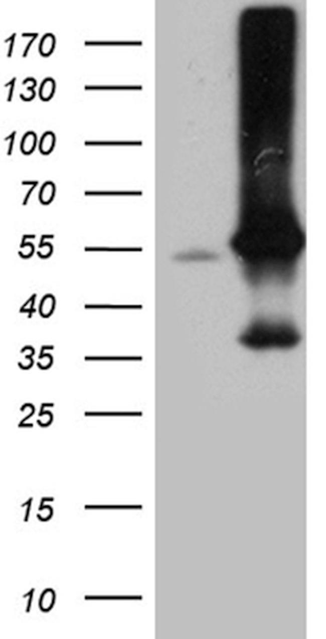 ARIH2 Antibody in Western Blot (WB)