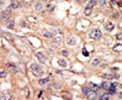 ARK5 Antibody in Immunohistochemistry (IHC)