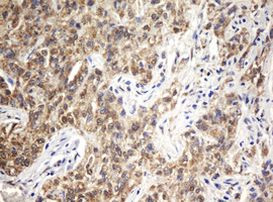 ARL2BP Antibody in Immunohistochemistry (Paraffin) (IHC (P))