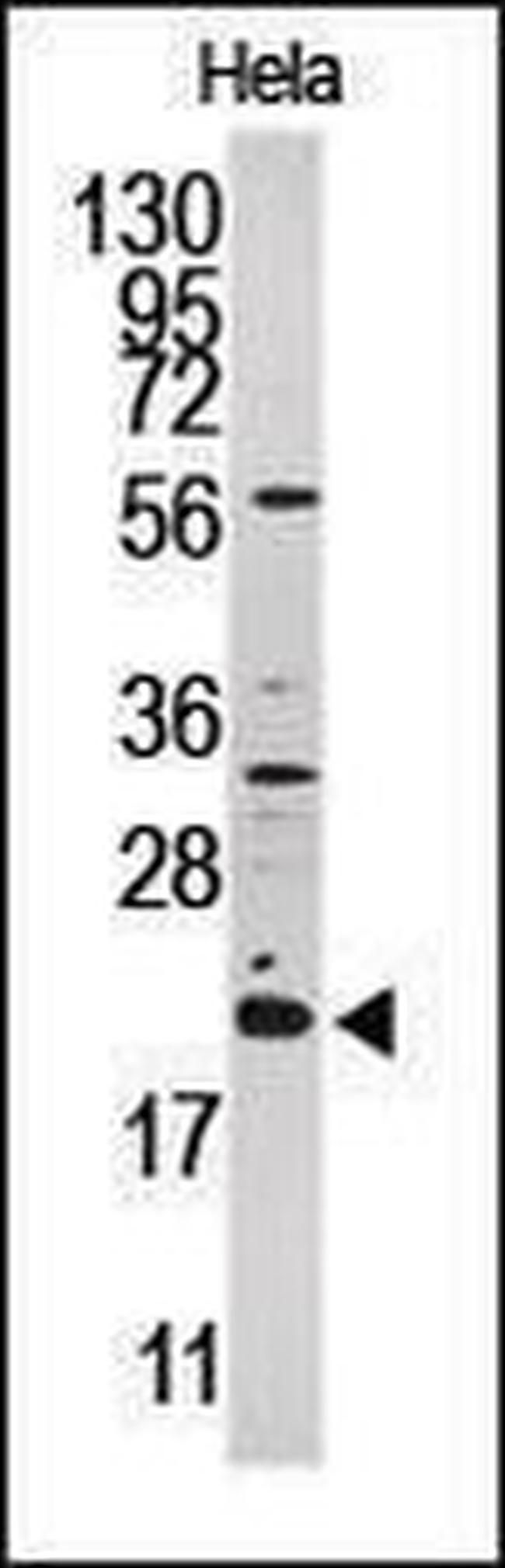 ARL2 Antibody in Western Blot (WB)