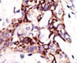 ARL3 Antibody in Immunohistochemistry (IHC)